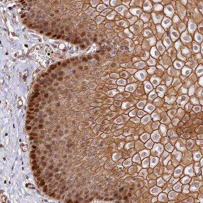 Immunohistochemistry-Paraffin: LINC02694 Antibody [NBP1-93829]