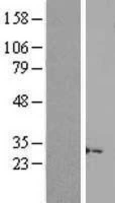 Western Blot: LINC02694 Overexpression Lysate [NBP2-04501]