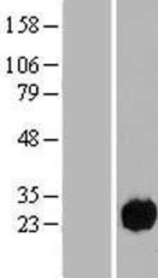 Western Blot: CCDC32 Overexpression Lysate [NBP2-05861]