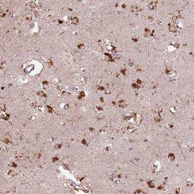 Immunohistochemistry-Paraffin: GDPGP1 Antibody [NBP2-14379]