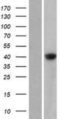 Western Blot: GDPGP1 Overexpression Lysate [NBP2-08727]