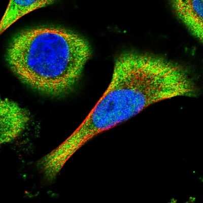 Immunocytochemistry/ Immunofluorescence: Inhibitory Synaptic Factor 1 Antibody [NBP1-93545]