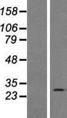 Western Blot: Inhibitory Synaptic Factor 1 Overexpression Lysate [NBP2-08580]