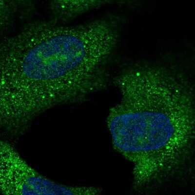 Immunocytochemistry/ Immunofluorescence: C15orf61 Antibody [NBP2-56802]