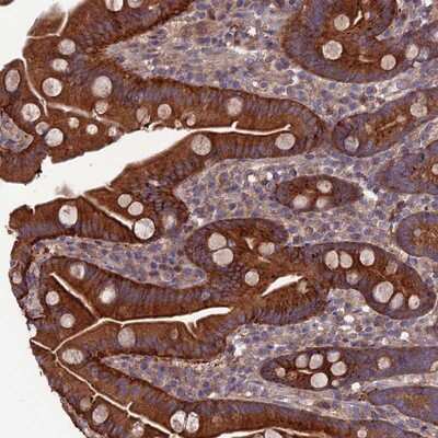 Immunohistochemistry-Paraffin: C15orf62 Antibody [NBP1-93538]