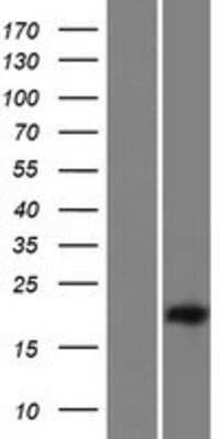 Western Blot: C15orf62 Overexpression Lysate [NBP2-09511]