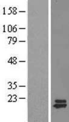 Western Blot: Huntingtin Interacting Protein K Overexpression Lysate [NBL1-11798]