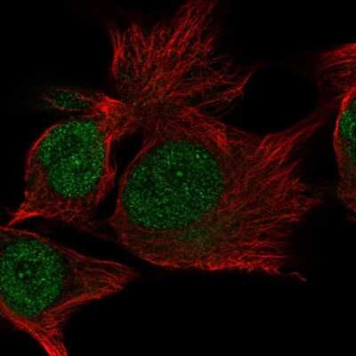 Immunocytochemistry/ Immunofluorescence: C15orf65 Antibody [NBP2-38100]