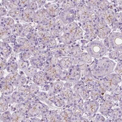 Immunohistochemistry: Proline Rich 35 Antibody [NBP2-48809]