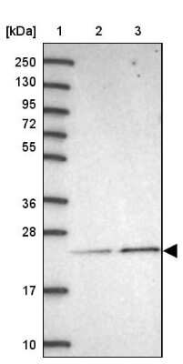 Western Blot: METTL26 Antibody [NBP2-48804]