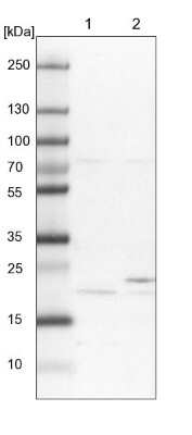 Western Blot: METTL26 Antibody [NBP2-48804]