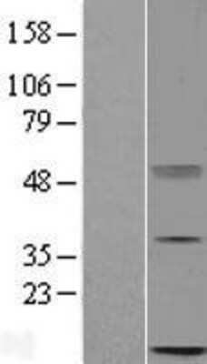 Western Blot: METTL26 Overexpression Lysate [NBL1-08209]