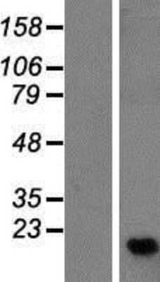 Western Blot: METTL26 Overexpression Lysate [NBP2-09930]