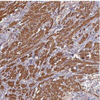 Immunohistochemistry: CCDC154 Antibody [NBP2-30849]