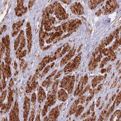 Immunohistochemistry: CCDC154 Antibody [NBP2-30875]