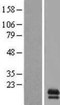 Western Blot: GAS8-AS1 Overexpression Lysate [NBL1-08210]