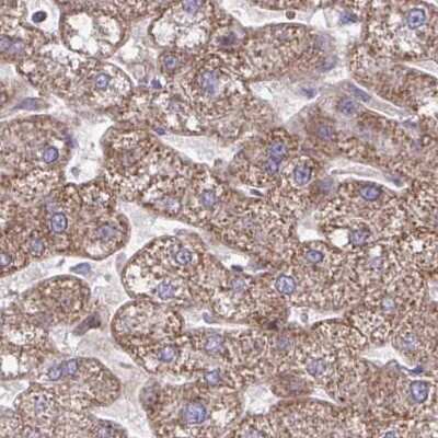 Immunohistochemistry: C16orf54 Antibody [NBP2-32553]