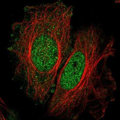 Immunocytochemistry/ Immunofluorescence: SPATA33 Antibody [NBP2-57726]