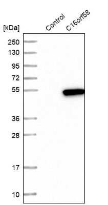 Western Blot: C16orf58 Antibody [NBP1-83692]