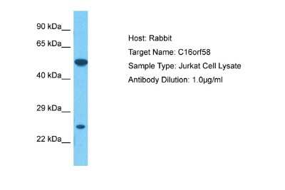 Western Blot: C16orf58 Antibody [NBP2-84540]