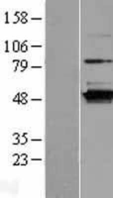 Western Blot: C16orf58 Overexpression Lysate [NBL1-08219]