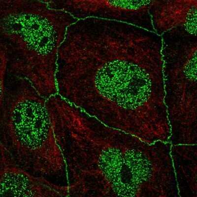 Immunocytochemistry/ Immunofluorescence: TEDC2 Antibody [NBP2-14383]