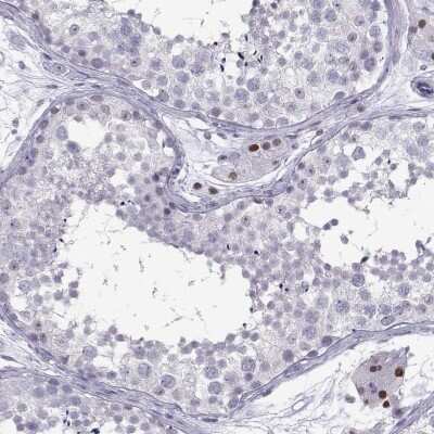 Immunohistochemistry-Paraffin: TEDC2 Antibody [NBP2-68718]