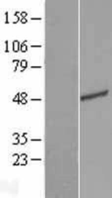 Western Blot: TEDC2 Overexpression Lysate [NBL1-08220]