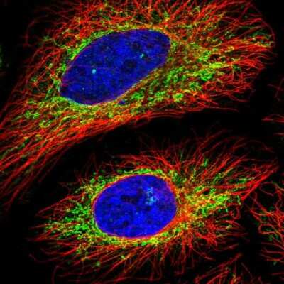 Immunocytochemistry/ Immunofluorescence: VPS35L Antibody [NBP2-58090]