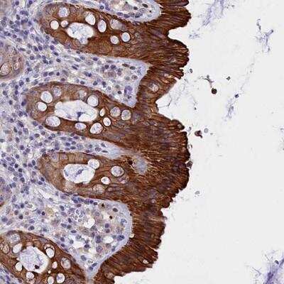 Immunohistochemistry-Paraffin: VPS35L Antibody [NBP1-82744]