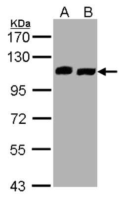 Western Blot: VPS35L Antibody [NBP1-32544]