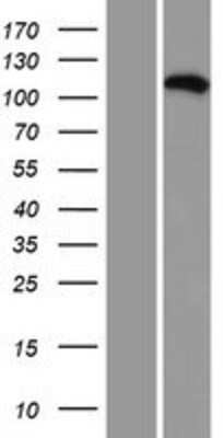 Western Blot: VPS35L Overexpression Lysate [NBP2-06667]