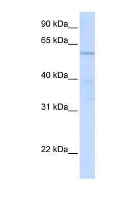 Western Blot: C16orf71 Antibody [NBP1-70439]