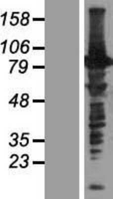 Western Blot: C16orf71 Overexpression Lysate [NBP2-05591]