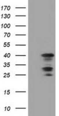 Western Blot: C16orf72 Antibody (OTI2D1) [NBP2-02850]