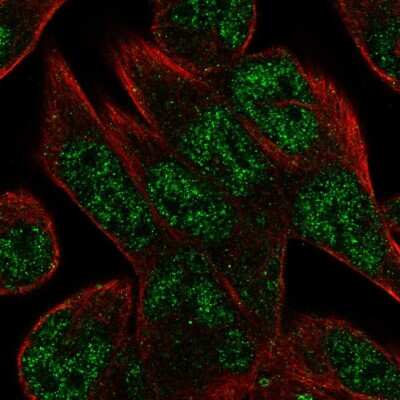 Immunocytochemistry/ Immunofluorescence: C16orf72 Antibody [NBP2-56955]