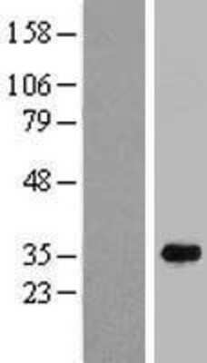 Western Blot: C16orf72 Overexpression Lysate [NBP2-07381]