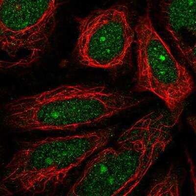 Immunocytochemistry/ Immunofluorescence: MEIOB Antibody [NBP2-14385]