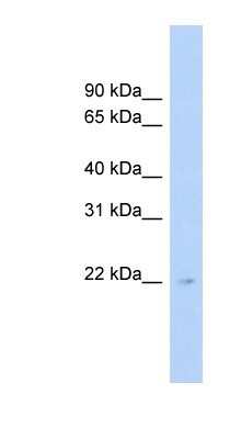 Western Blot: MEIOB Antibody [NBP1-70440]