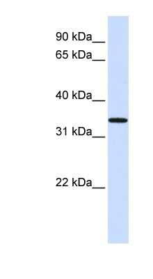 Western Blot: C16orf78 Antibody [NBP1-56418]