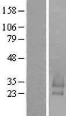 Western Blot: BRICD5 Overexpression Lysate [NBL1-08228]