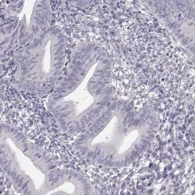 Immunohistochemistry-Paraffin: C16orf86 Antibody [NBP2-57936]