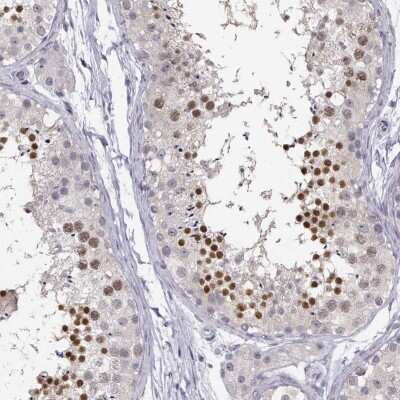 Immunohistochemistry-Paraffin: C16orf86 Antibody [NBP2-57936]