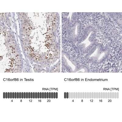 Immunohistochemistry-Paraffin: C16orf86 Antibody [NBP2-57936]