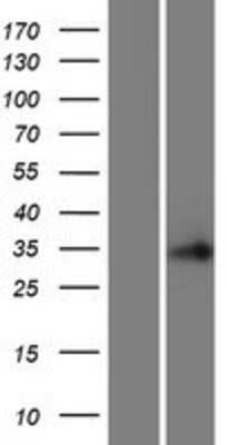 Western Blot: C16orf86 Overexpression Lysate [NBP2-08714]