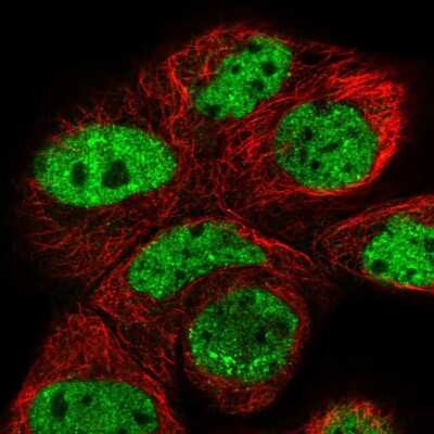 Immunocytochemistry/ Immunofluorescence: C16orf87 Antibody [NBP1-86230]