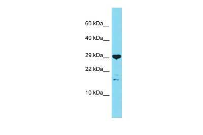 Western Blot: C16orf87 Antibody [NBP2-82851]