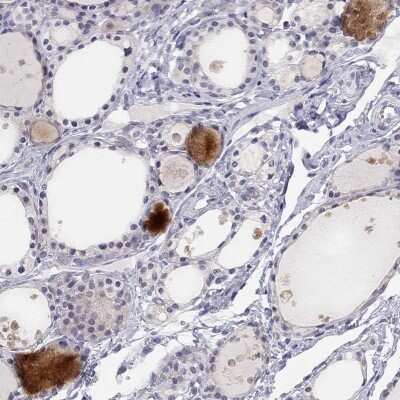 Immunohistochemistry-Paraffin: C16orf89 Antibody [NBP1-93470]