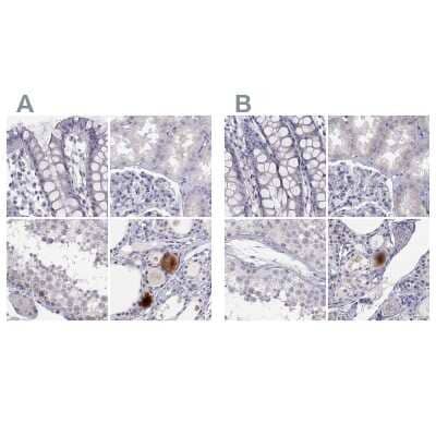 Immunohistochemistry-Paraffin: C16orf89 Antibody [NBP1-93470]