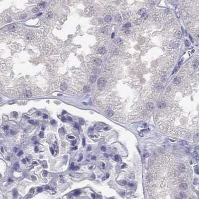 Immunohistochemistry-Paraffin: C16orf89 Antibody [NBP1-93470]